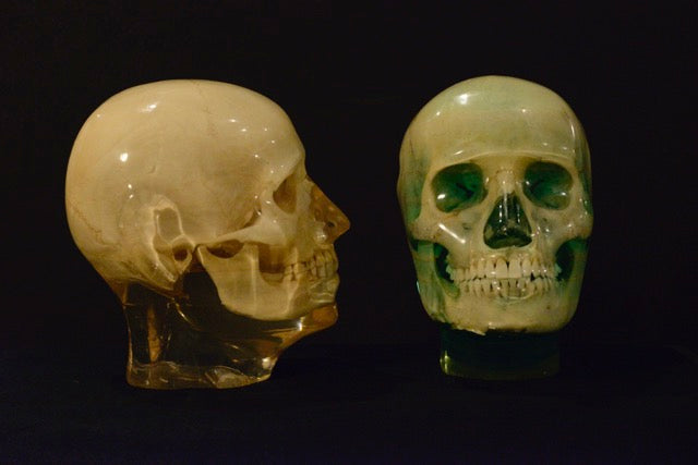 X-Ray Phantom Skull A