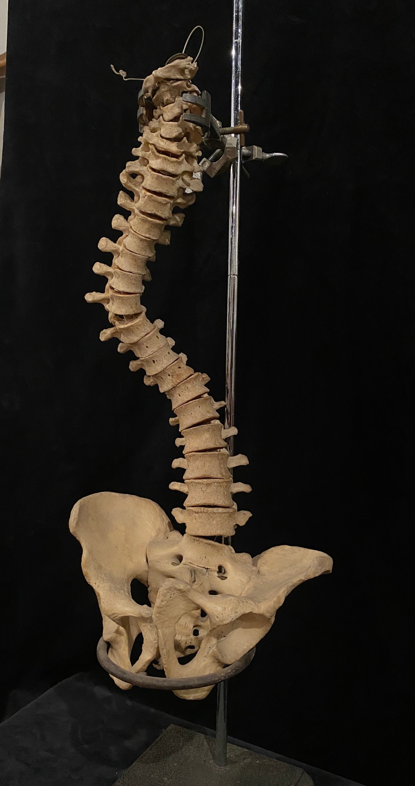Human Vertebrae with Pelvic Bone