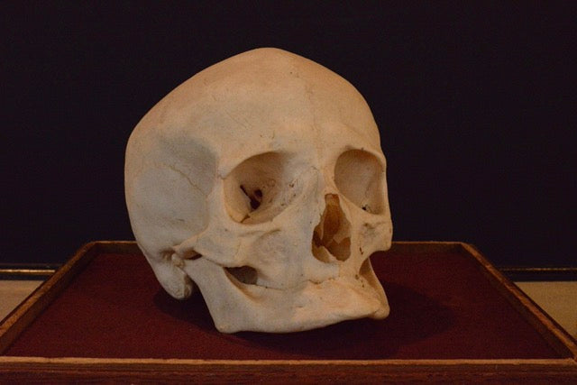 Uncut Geriatric Skull H1
