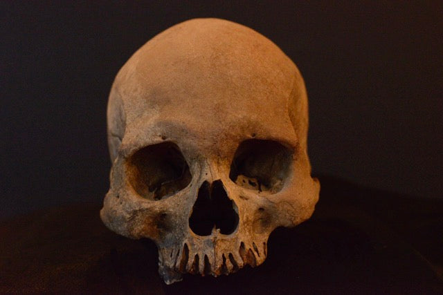 Uncut Skull H7_Double Suture Marks