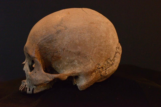 Uncut Skull H7_Double Suture Marks