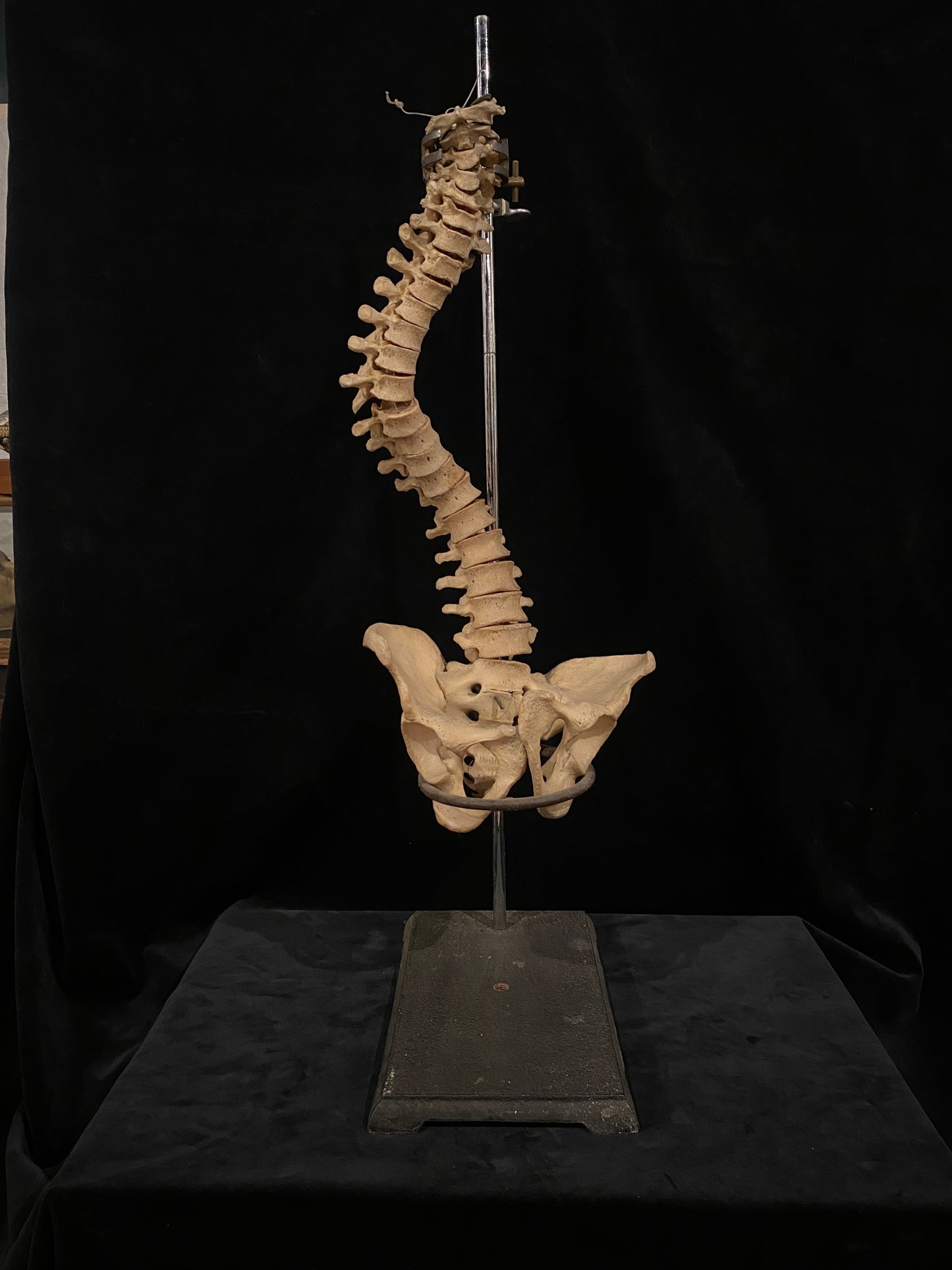 Human Vertebrae with Pelvic Bone