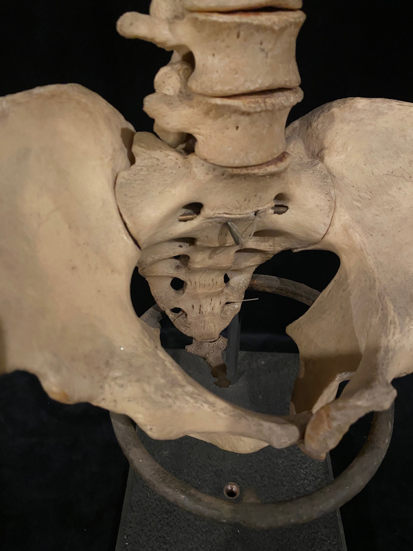 Human Vertebrae with Pelvic Bone