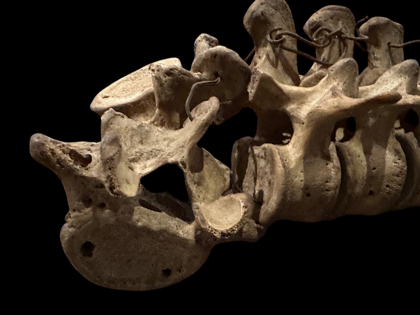 Human Vertabrae Column