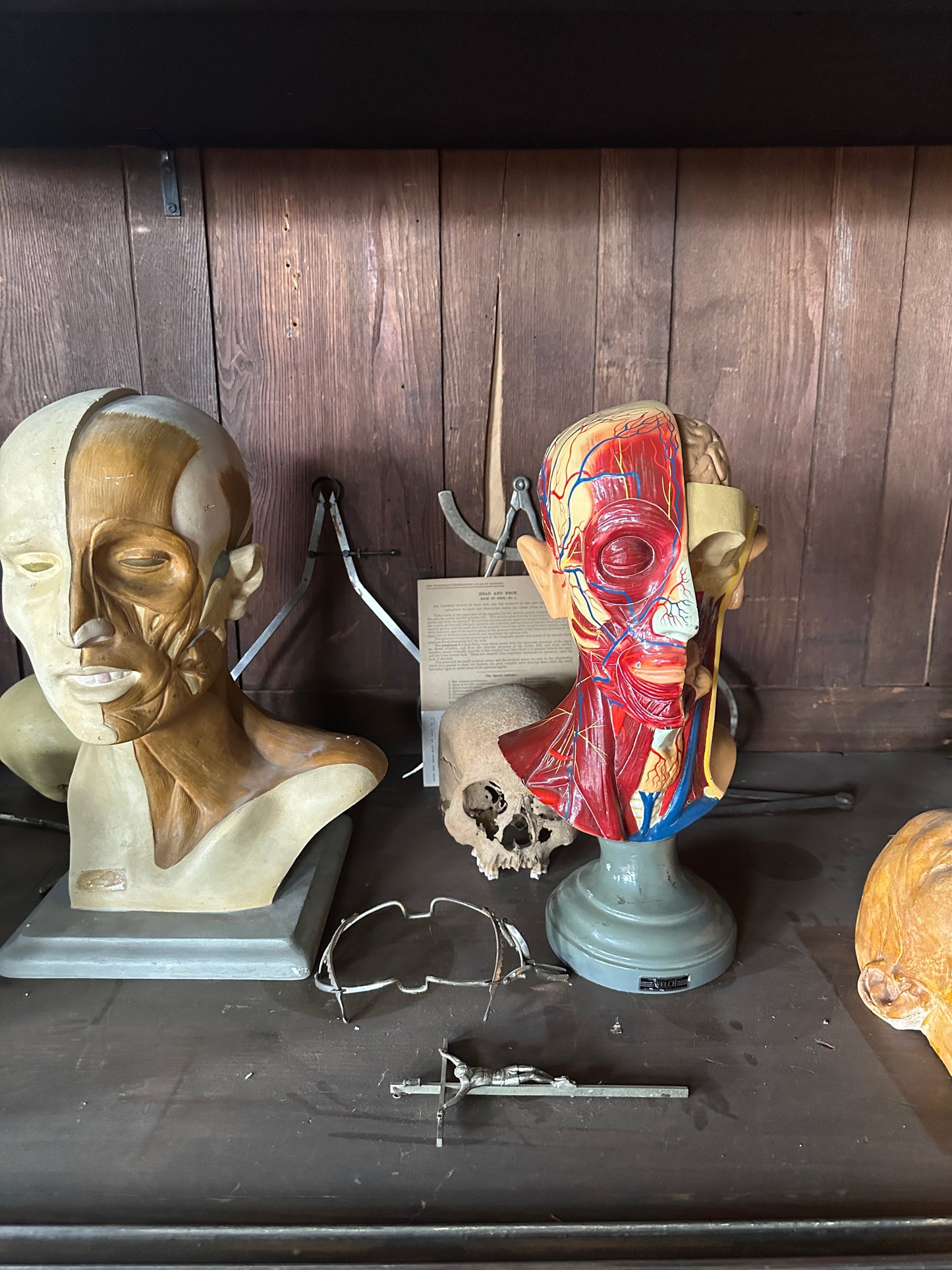 Vintage Anatomical Educational Model: Head
