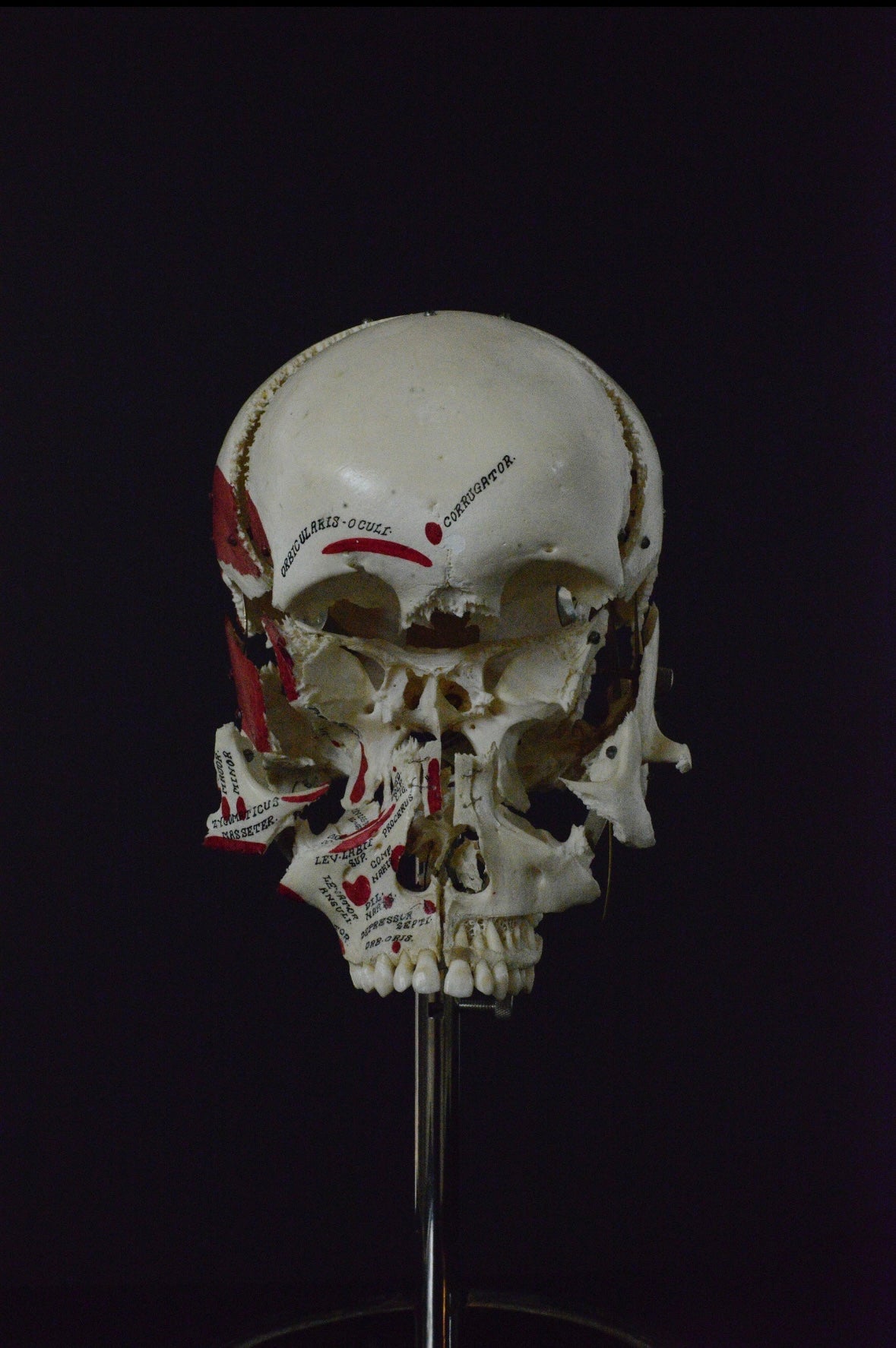 Authentic Exploding Skull: Beauchene Skull