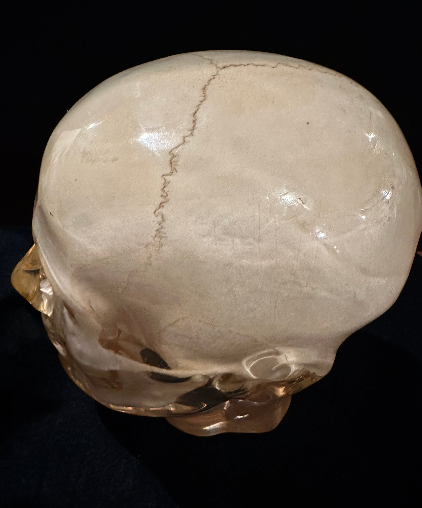 X-Ray Phantom Skull A