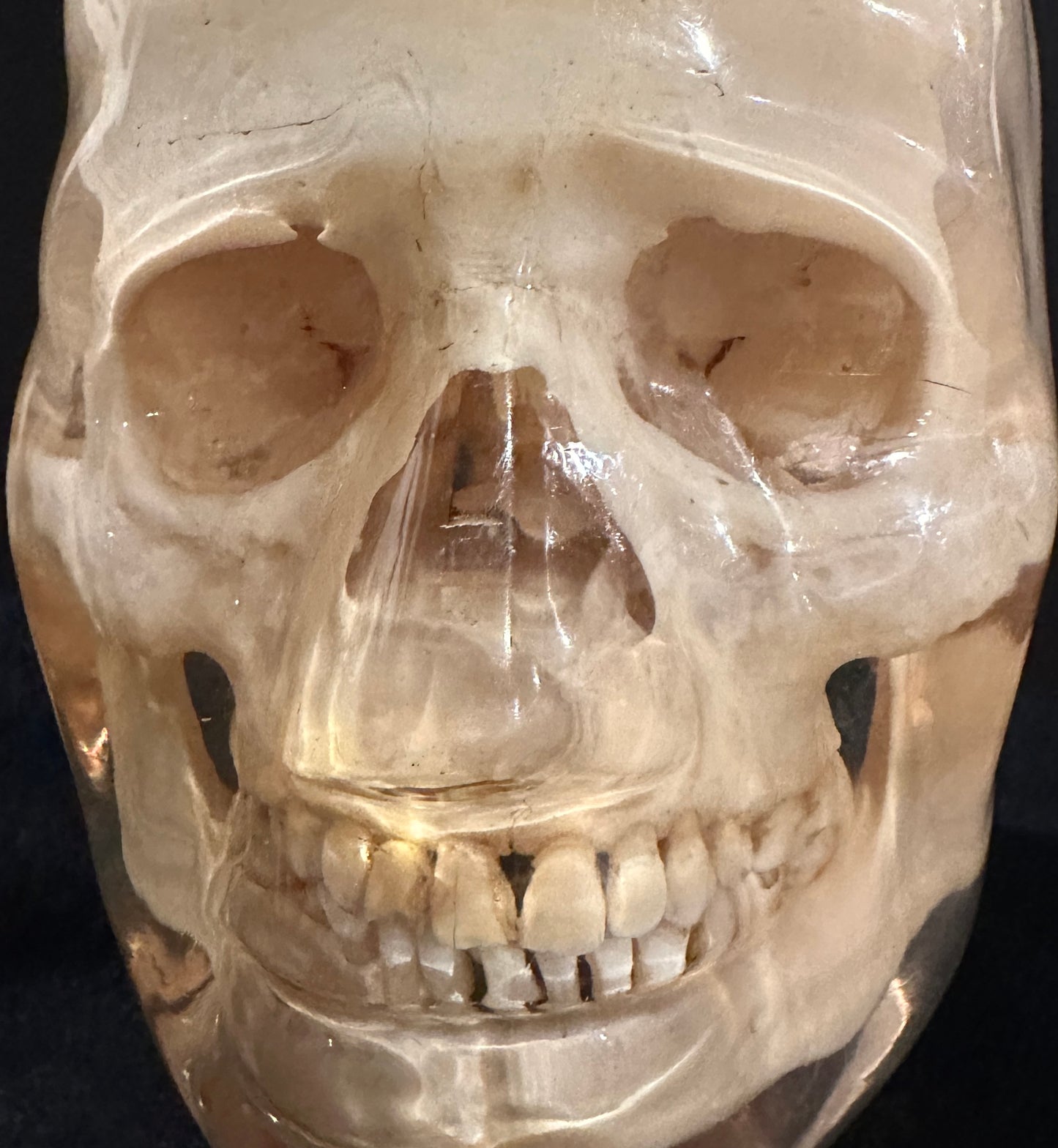 X-Ray Phantom Skull A
