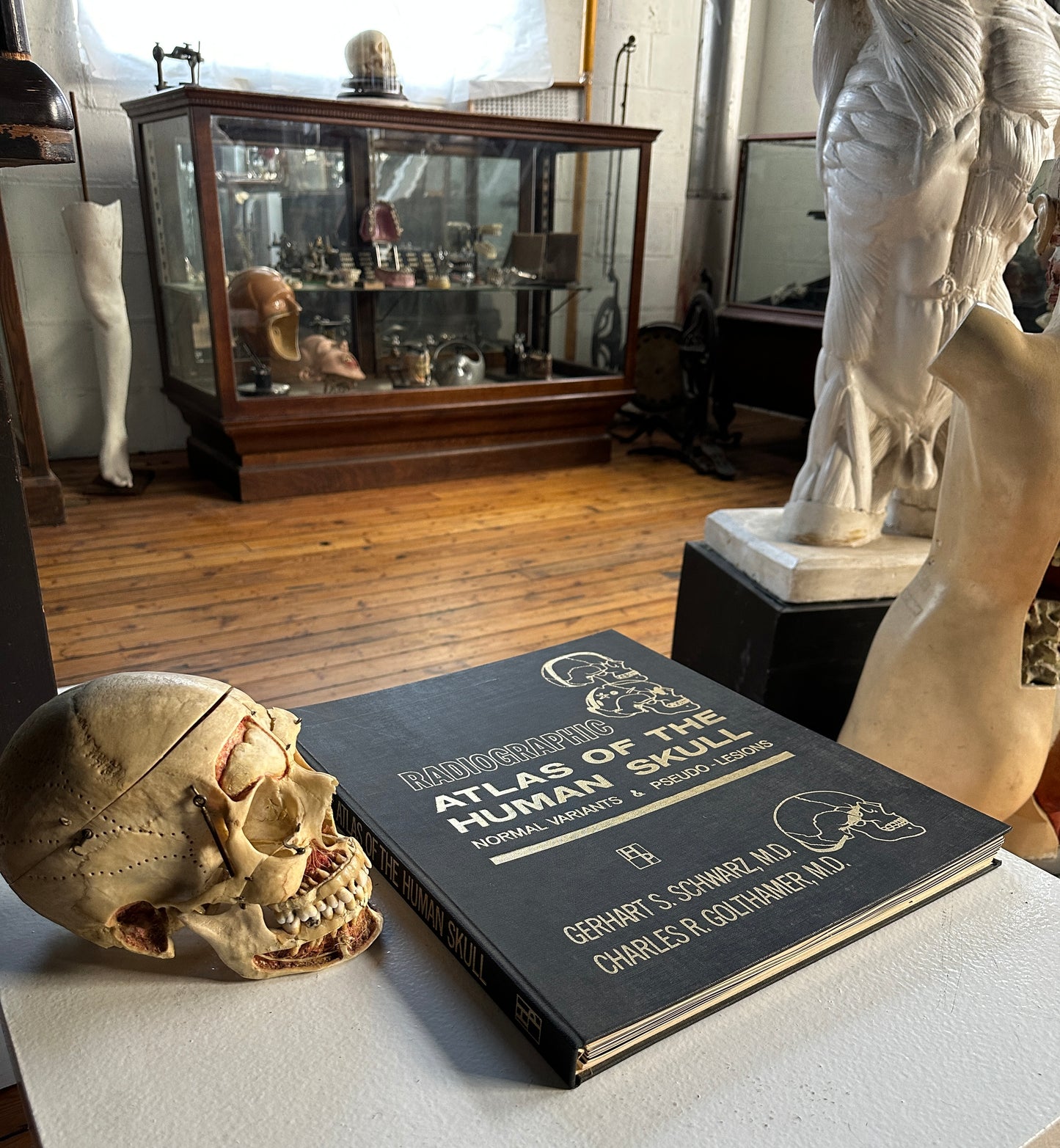 Radiographic Atlas of the Human Skull Book