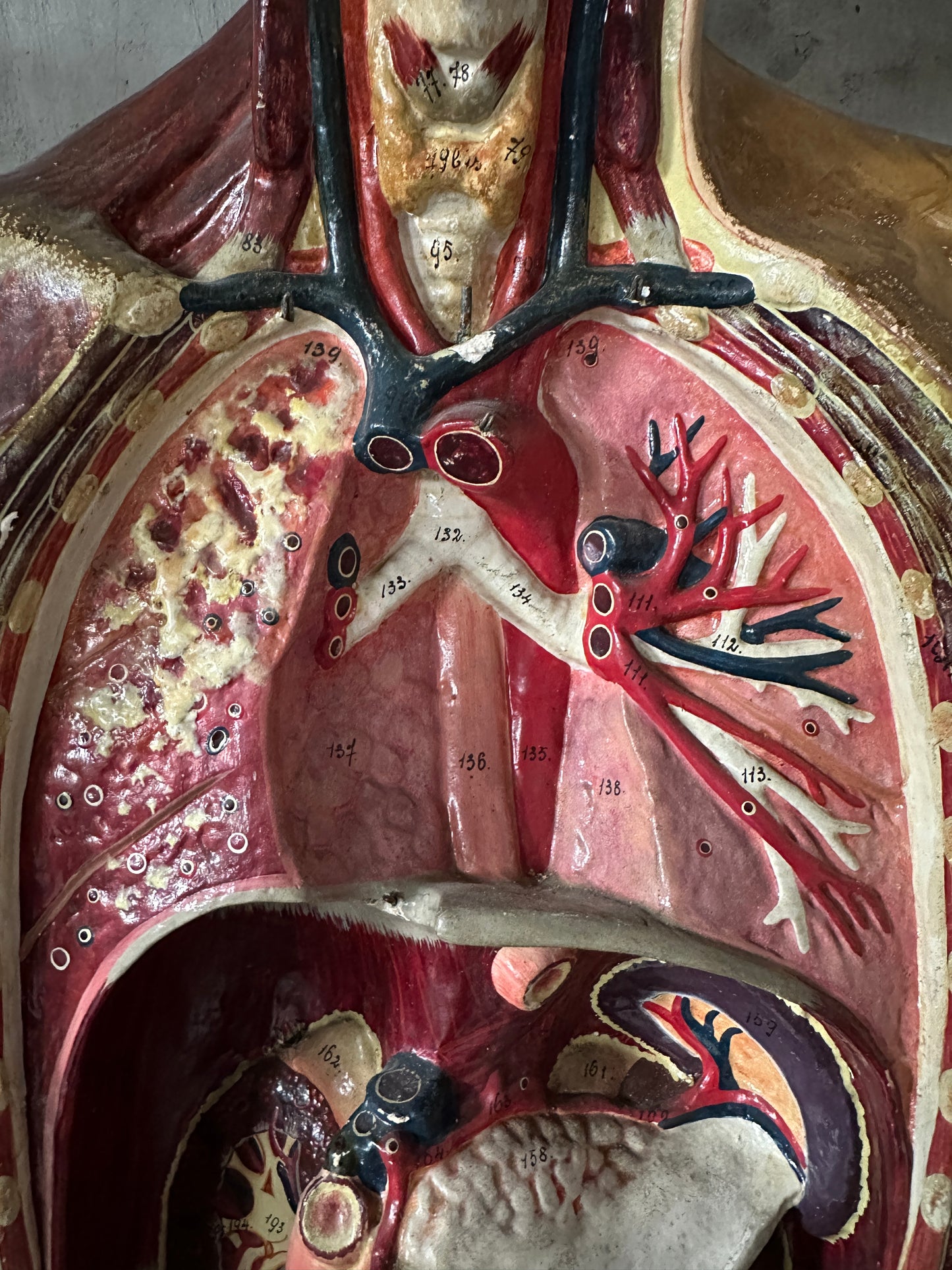 Torso Anatomico Didattico del 1900