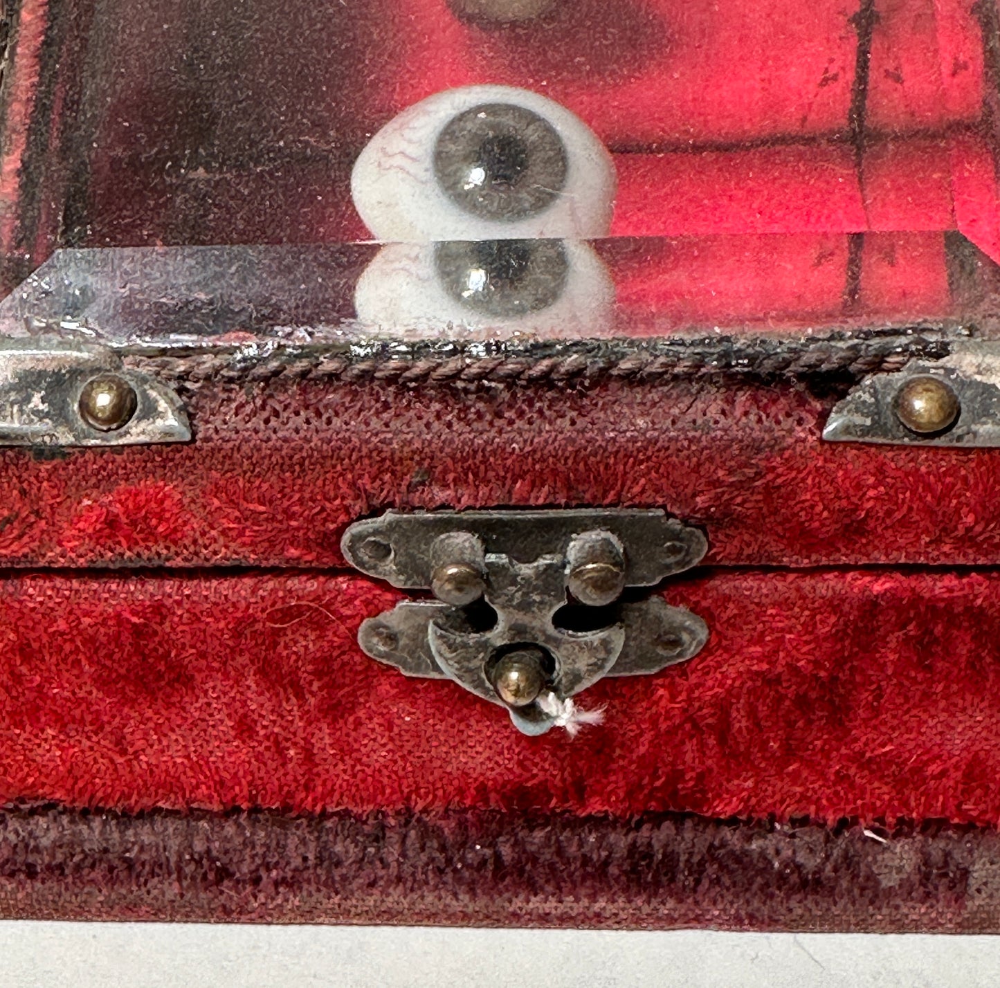 Prosthetic Eye Displayed in Ormolu Jewelry Casket