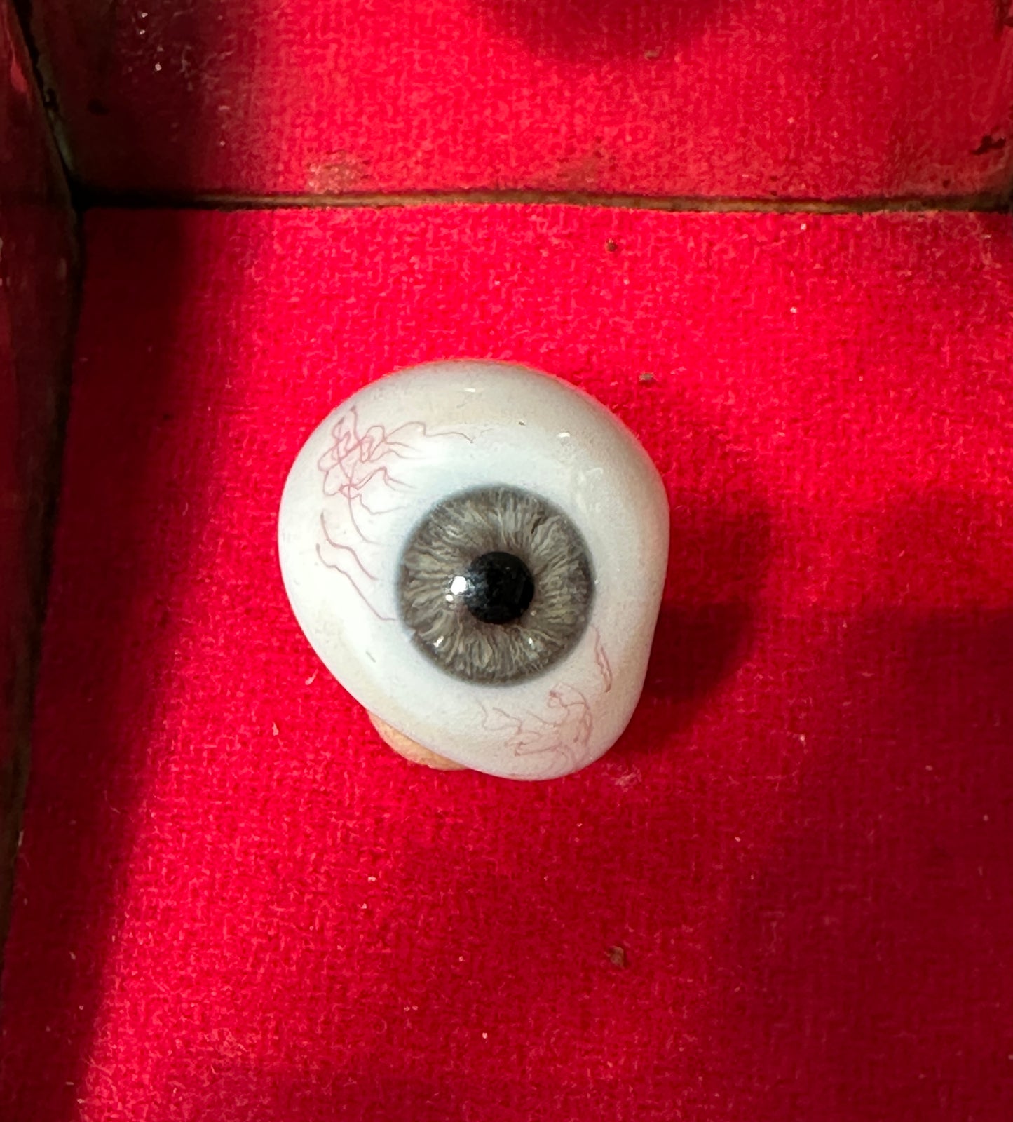 Prosthetic Eye Displayed in Ormolu Jewelry Casket