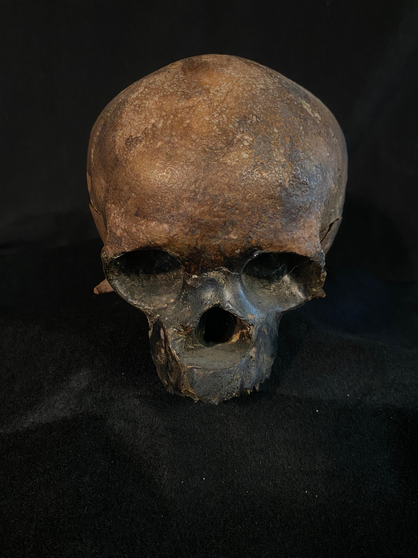 H_A16 Human Skull