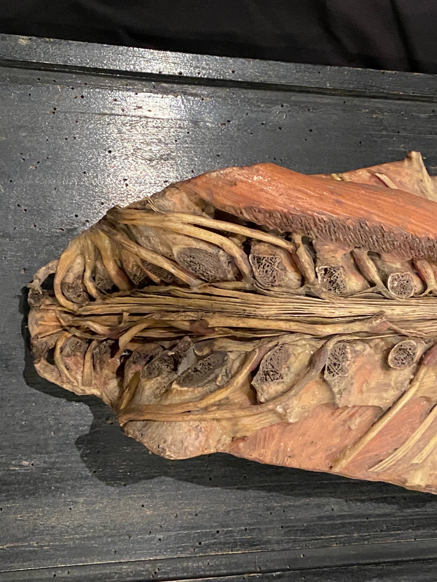 Tramond Wax Anatomical Model