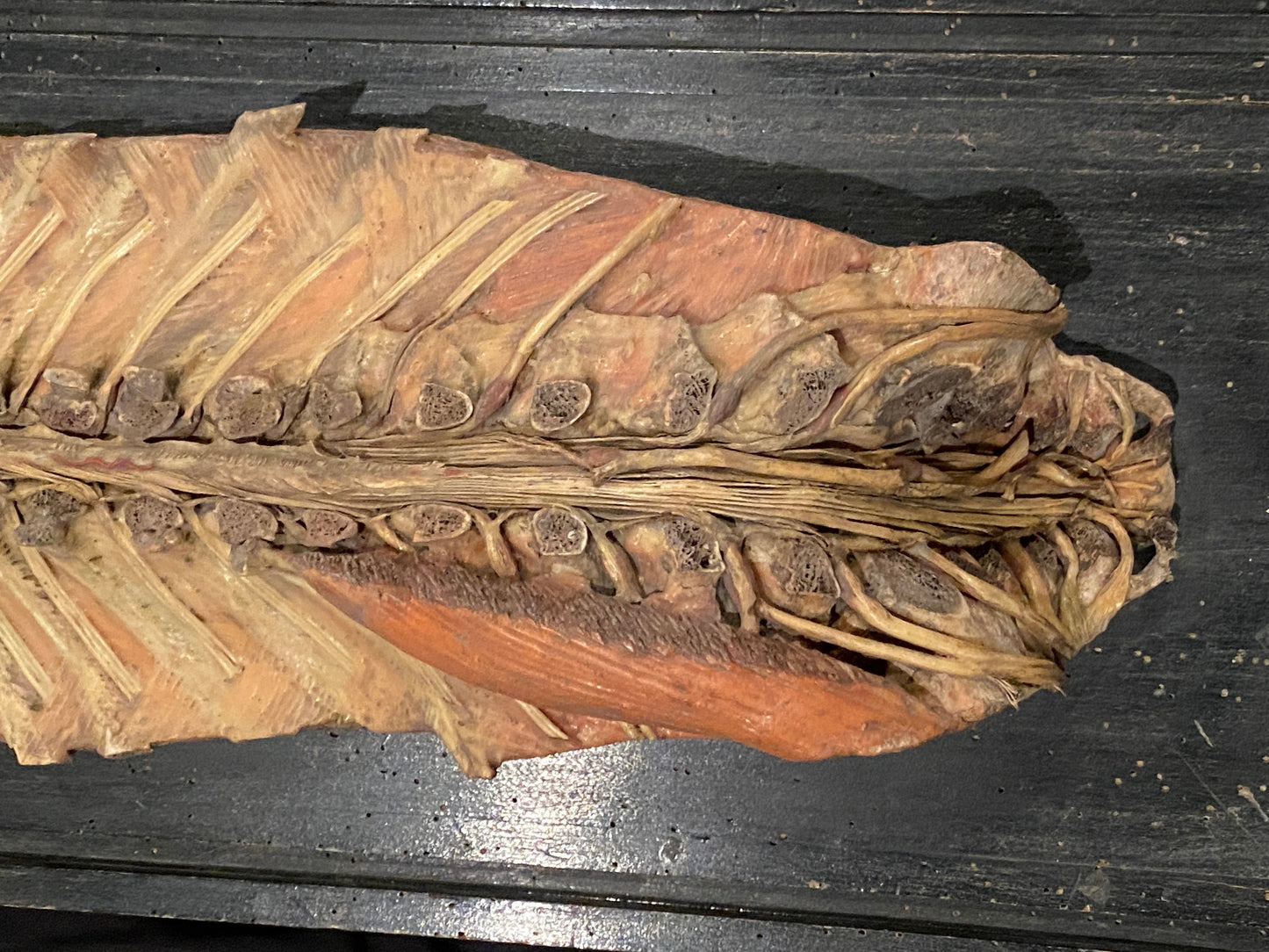 Tramond Wax Anatomical Model