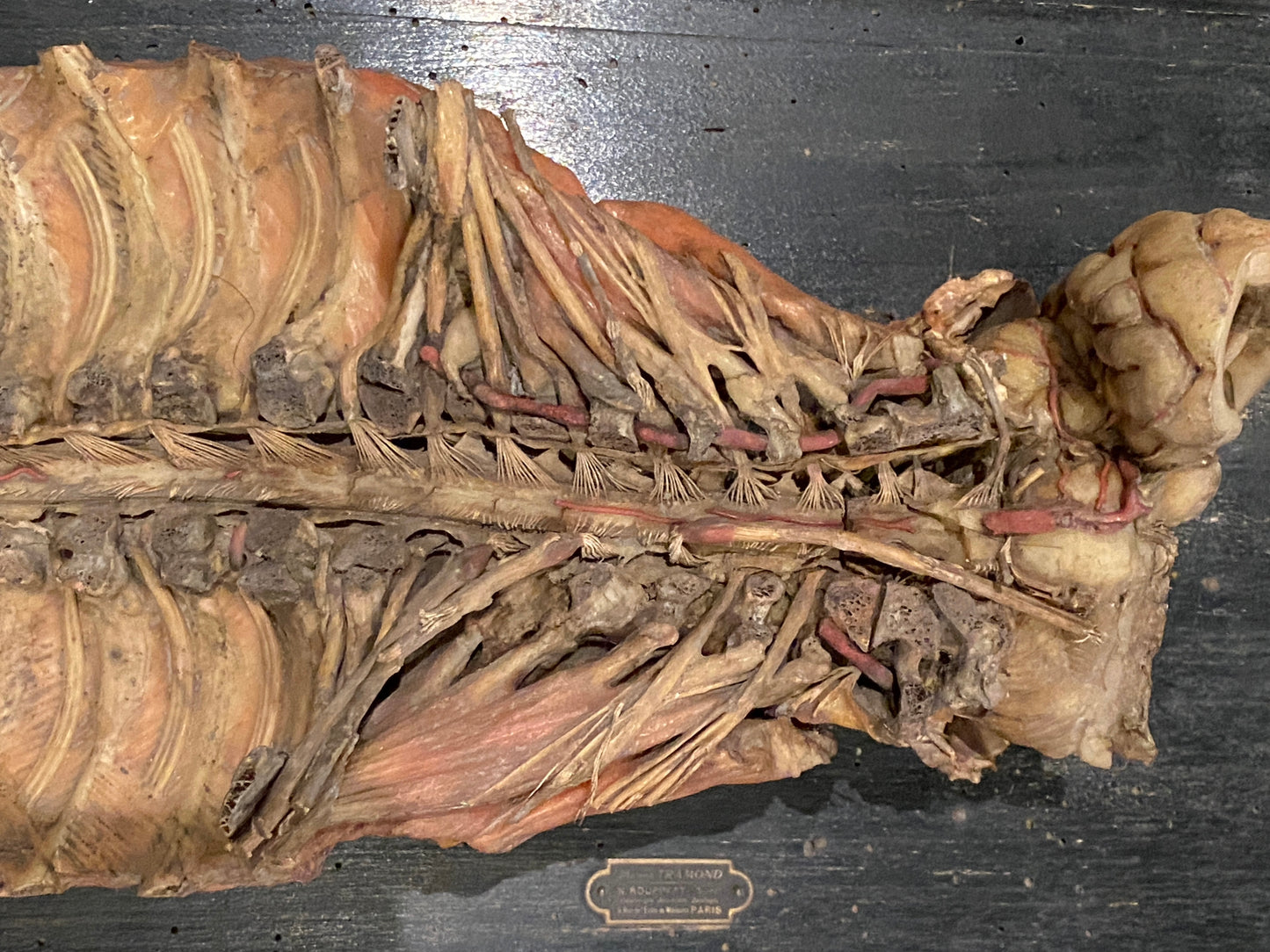 Tramond Wax Anatomical Model