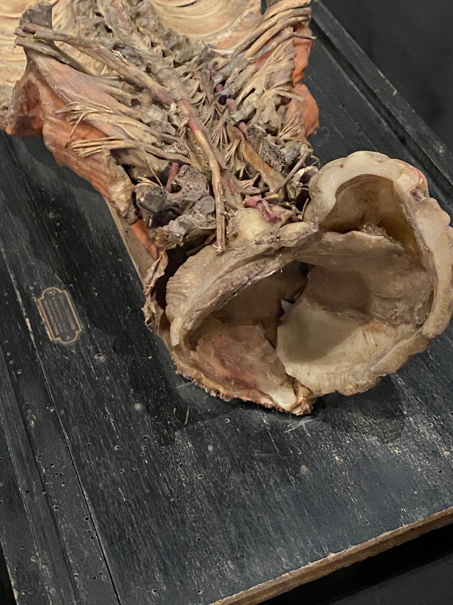 Tramond Wax Anatomical Model