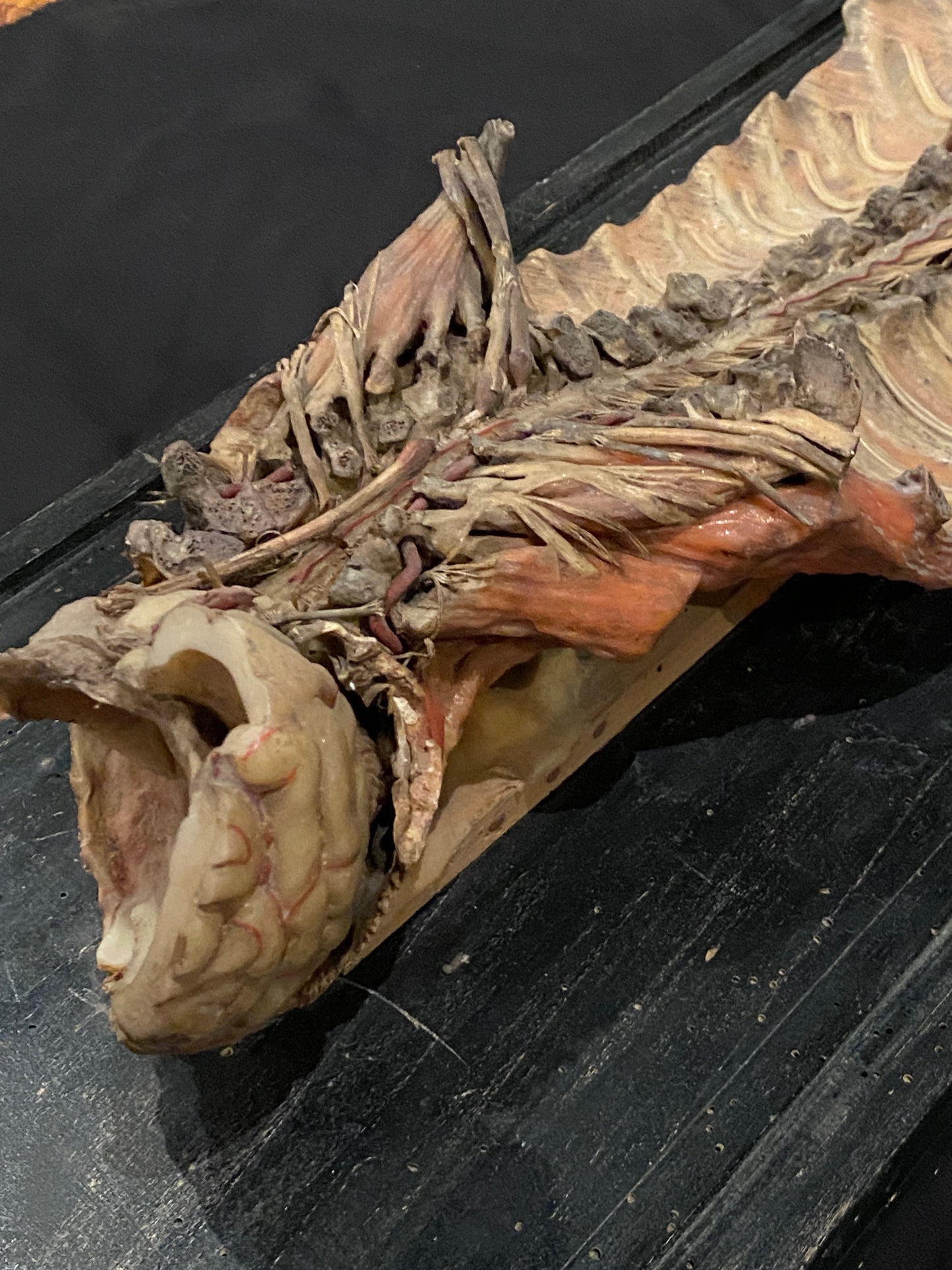 Tramond Wax Anatomical Model