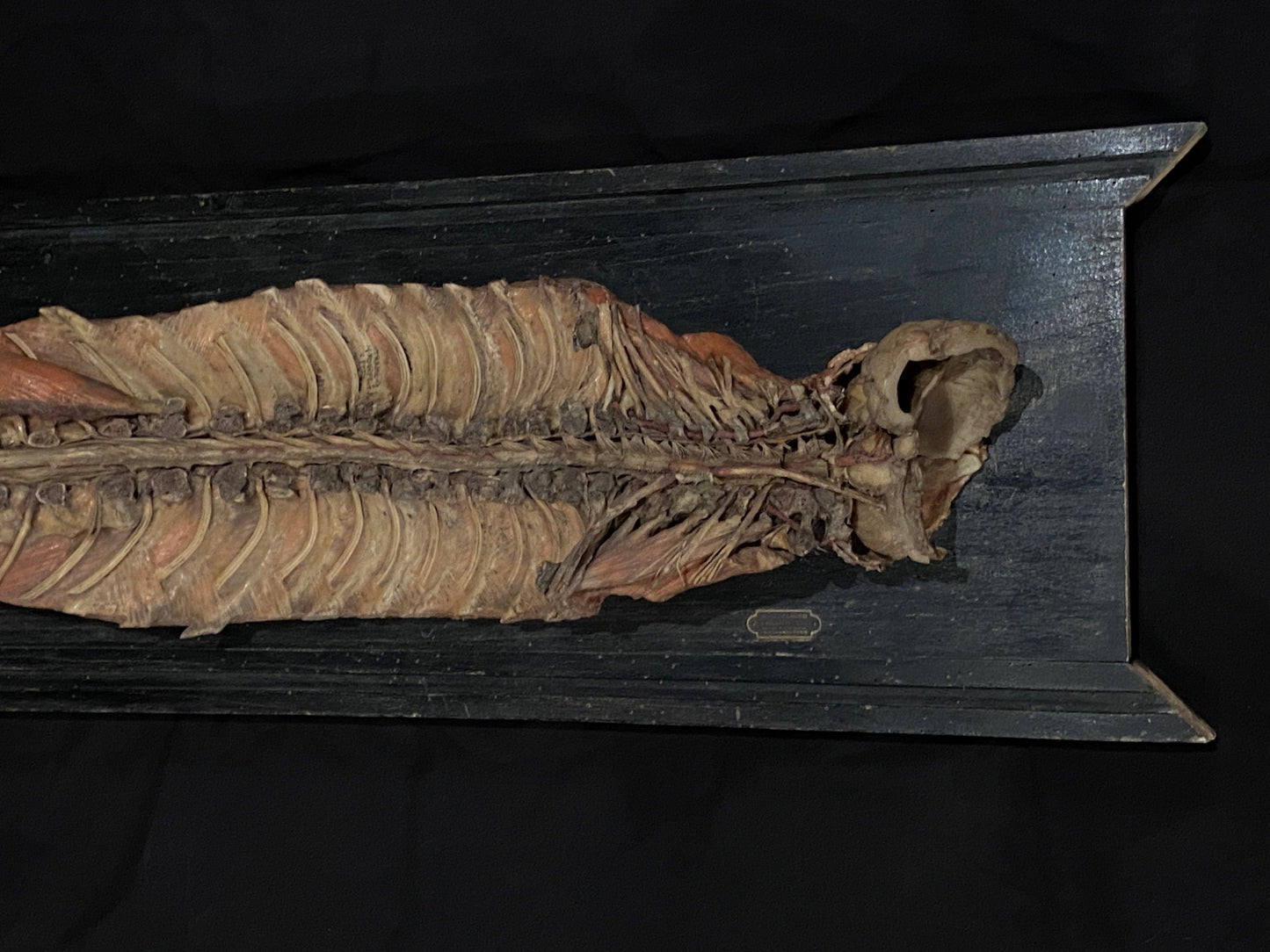 Tramond Wax Anatomical Model
