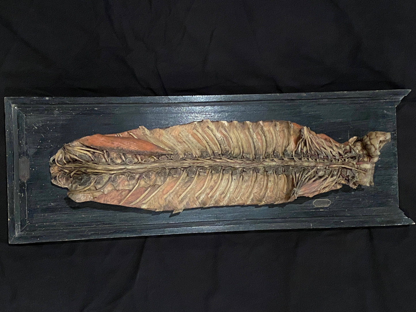Tramond Wax Anatomical Model