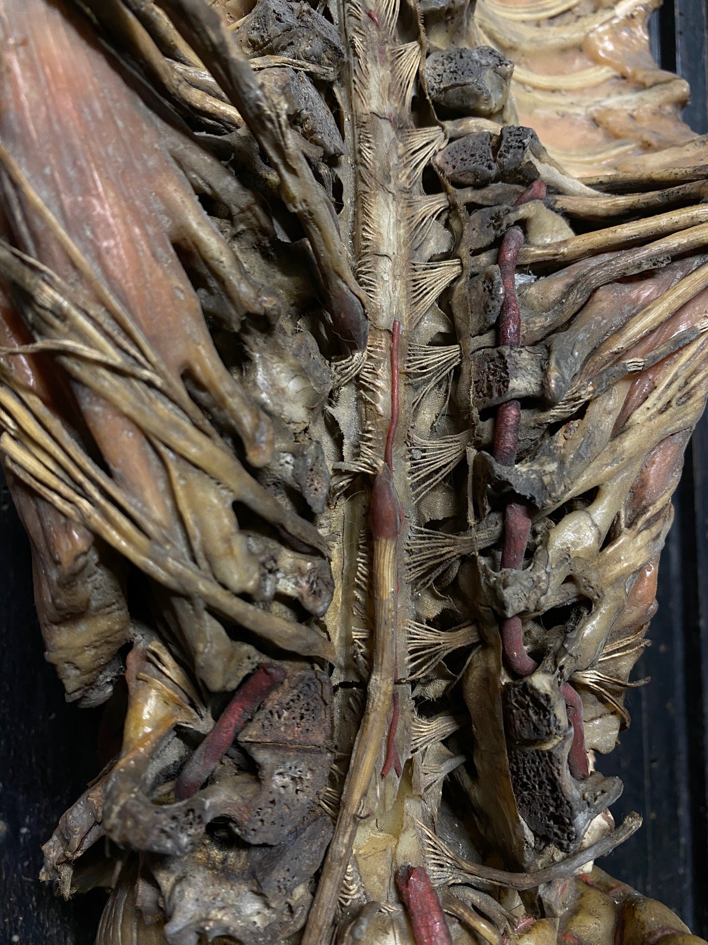 Tramond Wax Anatomical Model