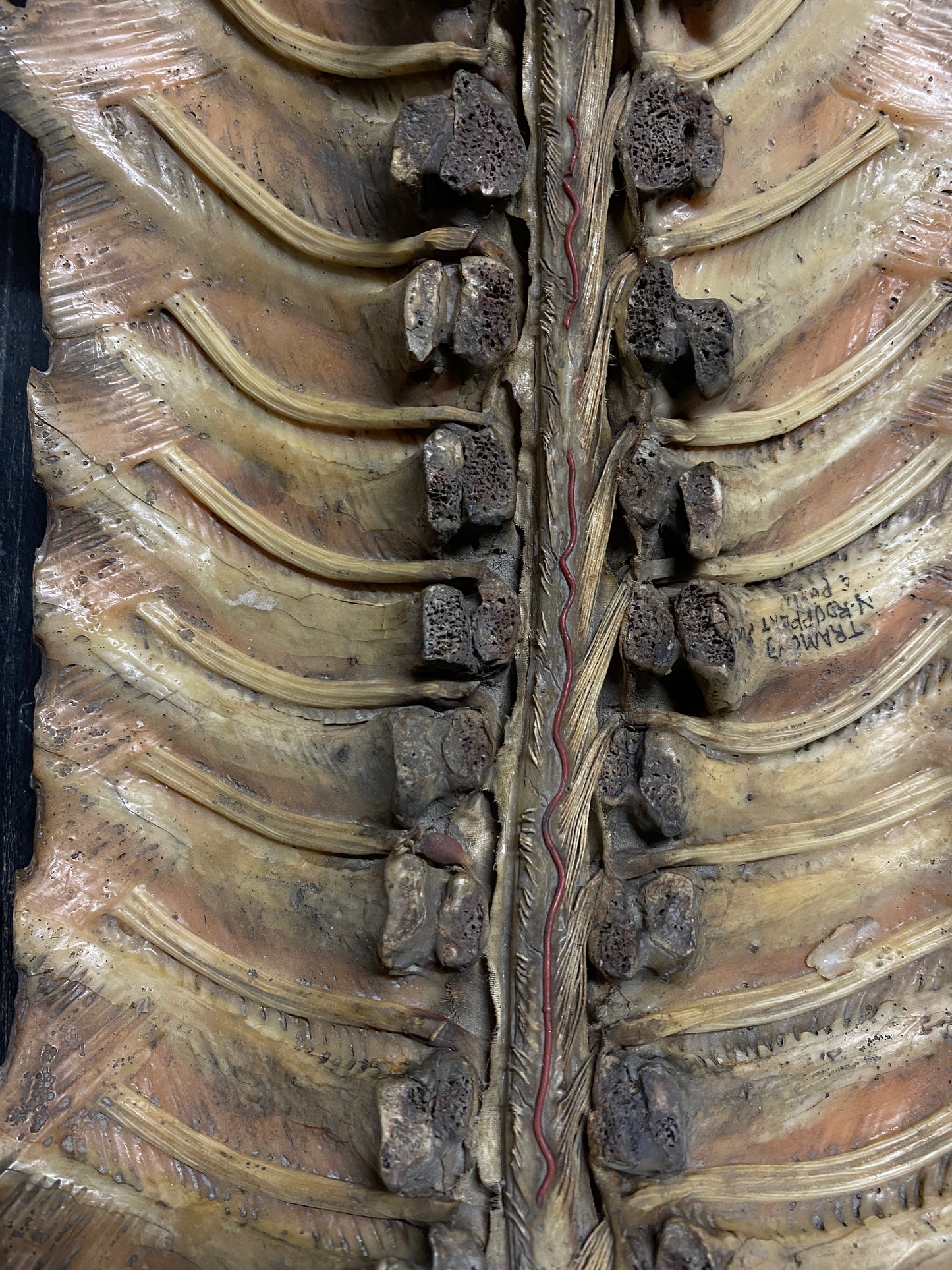 Tramond Wax Anatomical Model
