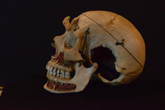 Authentic Human Skull Dissection