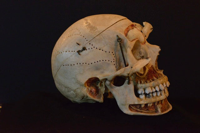 Authentic Human Skull Dissection