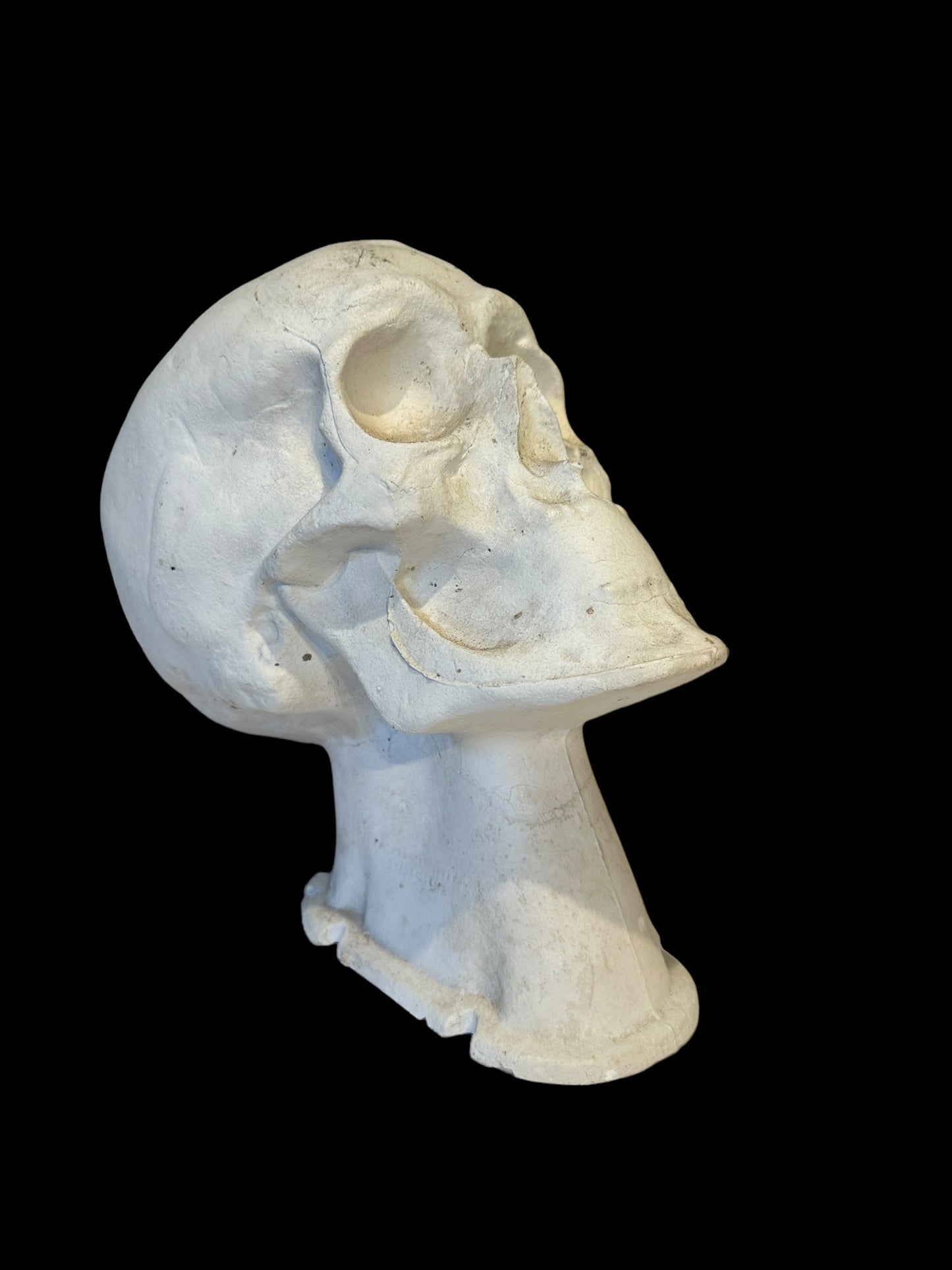 Rare Antique Funeral Mortician Mortuary Medical Facial Skull Reconstruction
