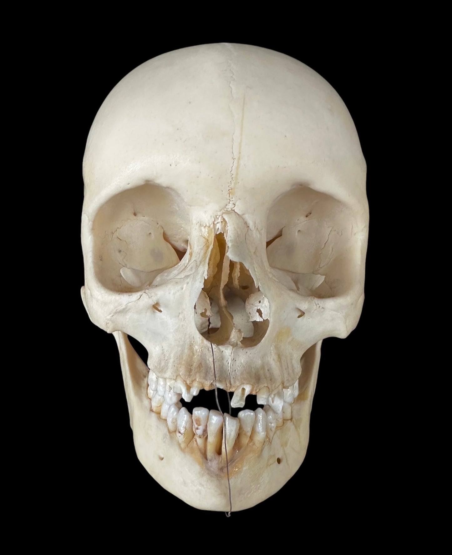 Uncut Skull With Mandible