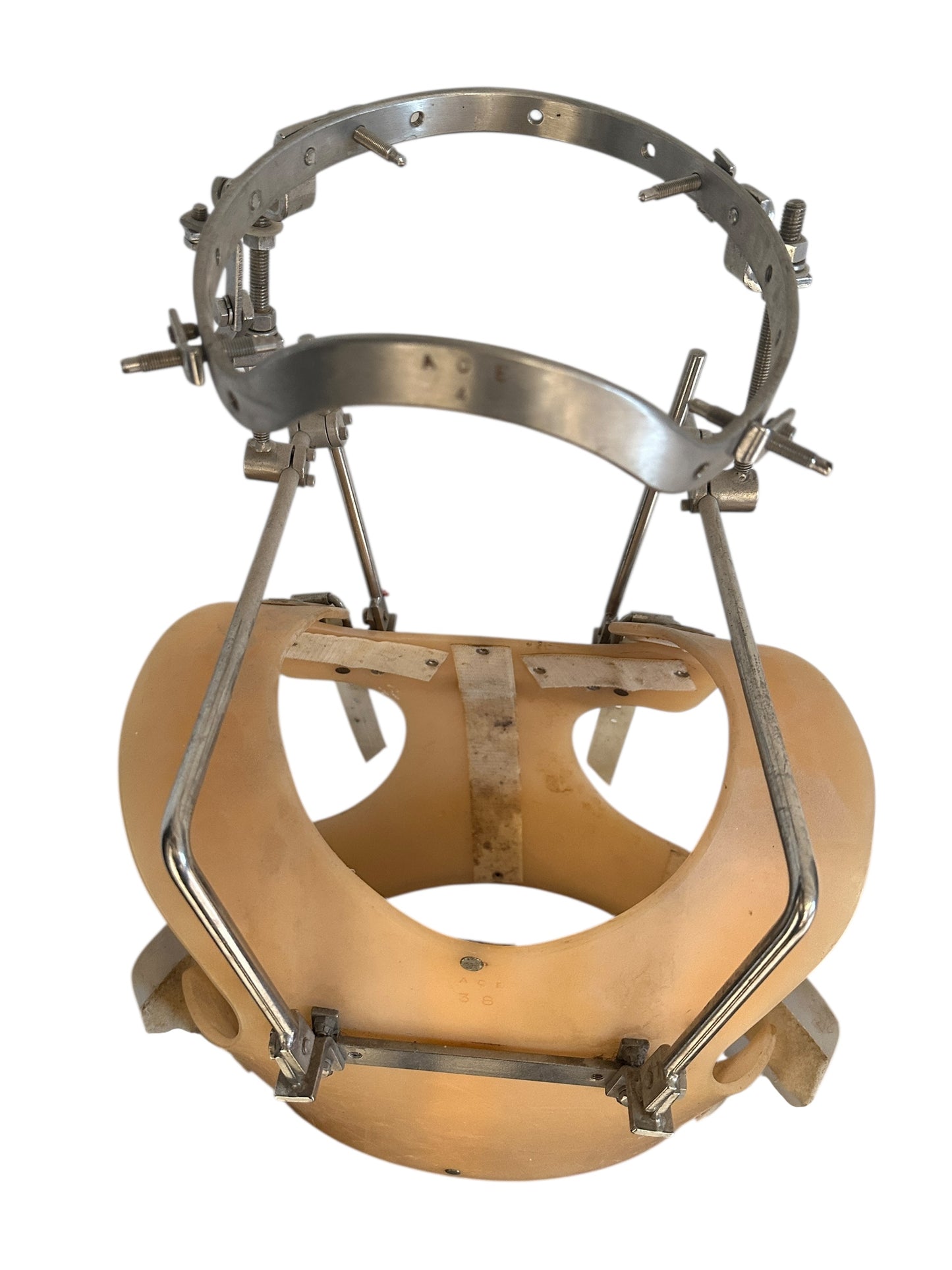 Halo-Gravity Traction: Treat Spinal Deformities