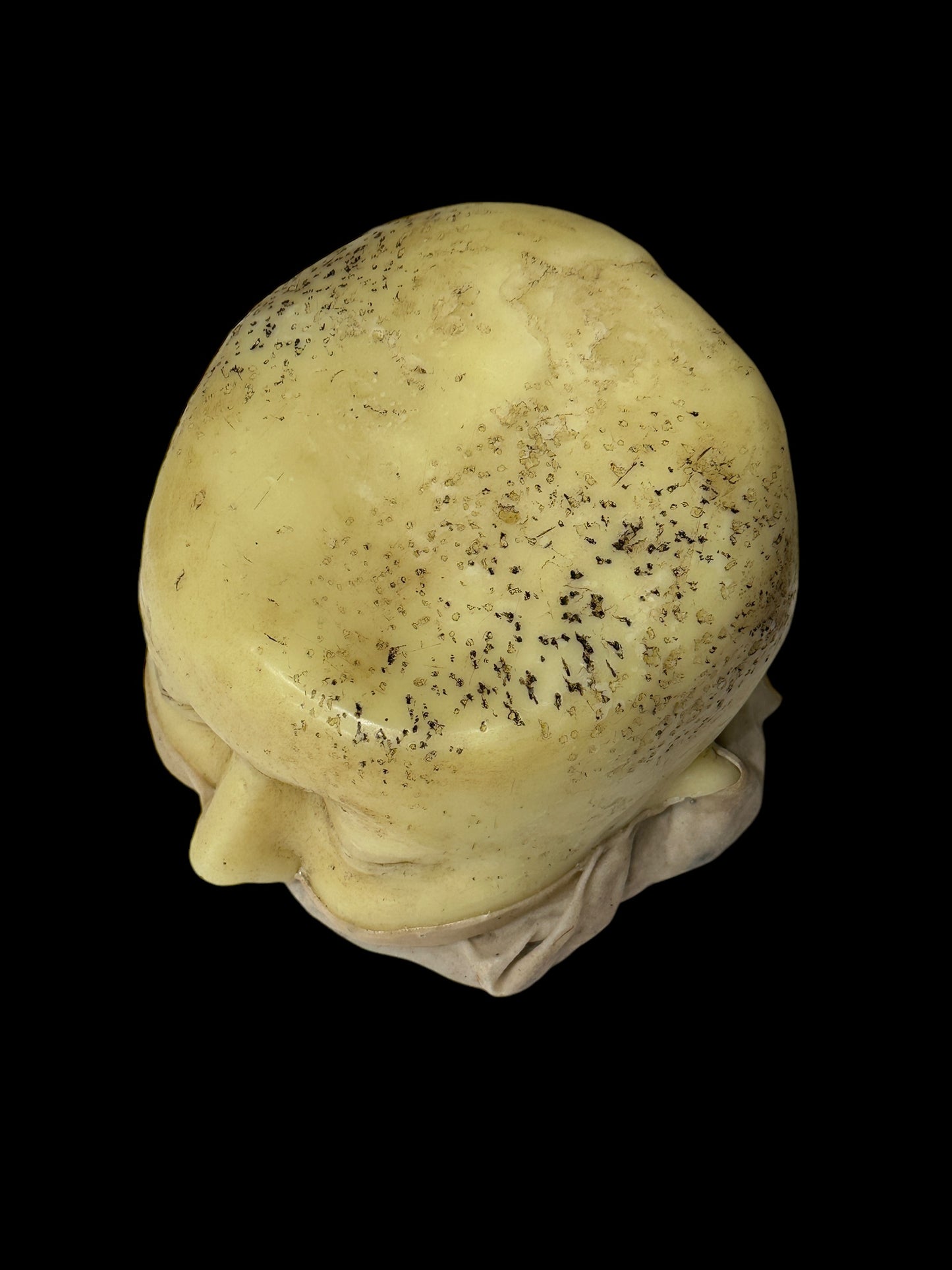 Antique 1890s Medical Wax Moulage Death Mask