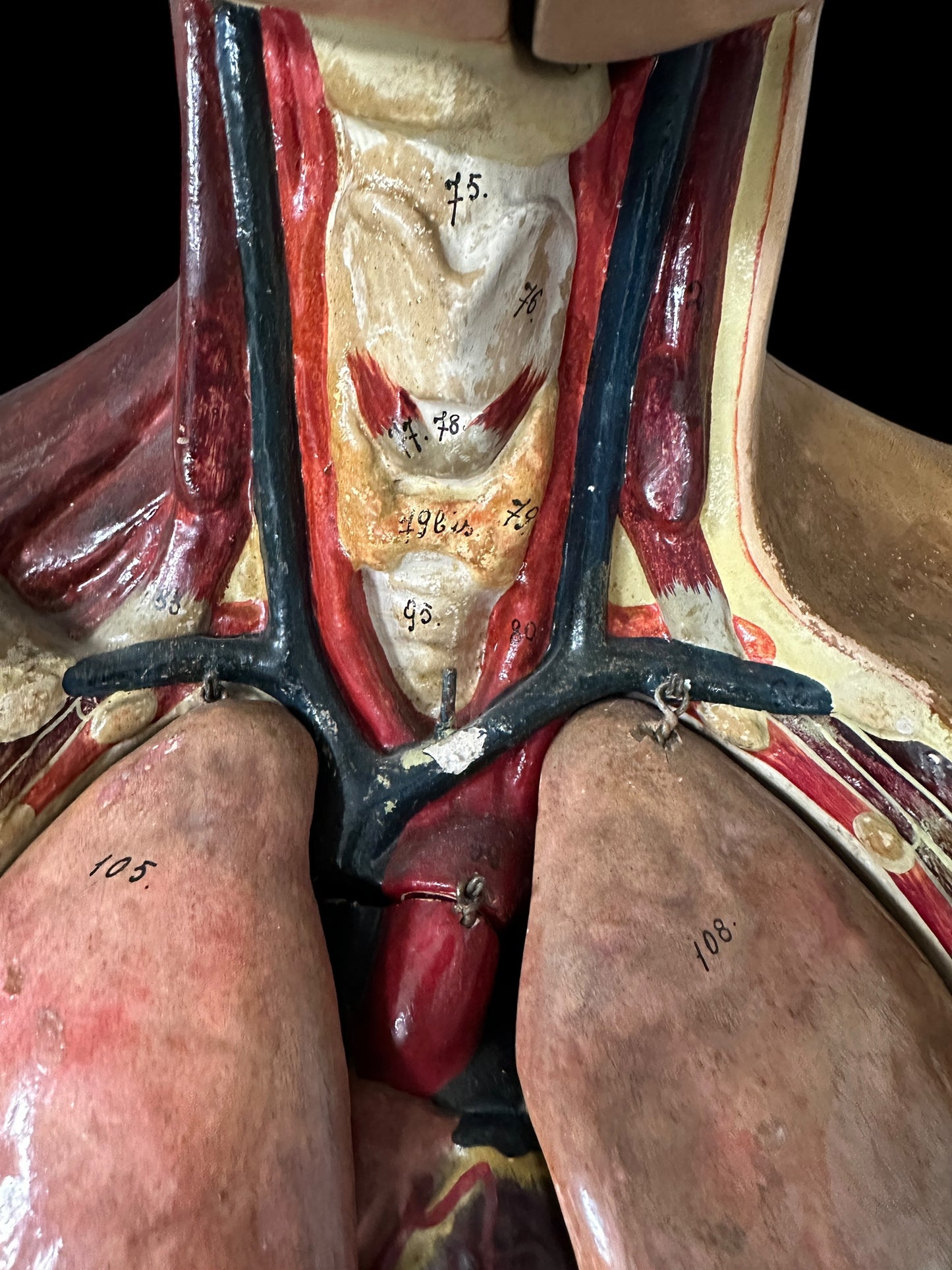 Torso Anatomico Didattico del 1900