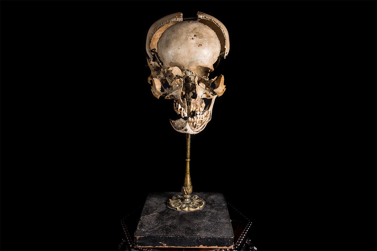 Beauchene Human Exploding Skull