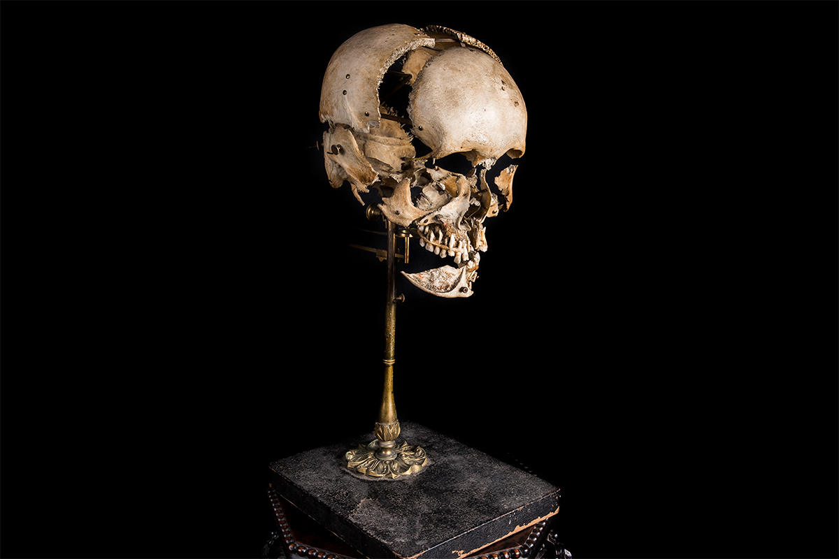 Beauchene Human Exploding Skull