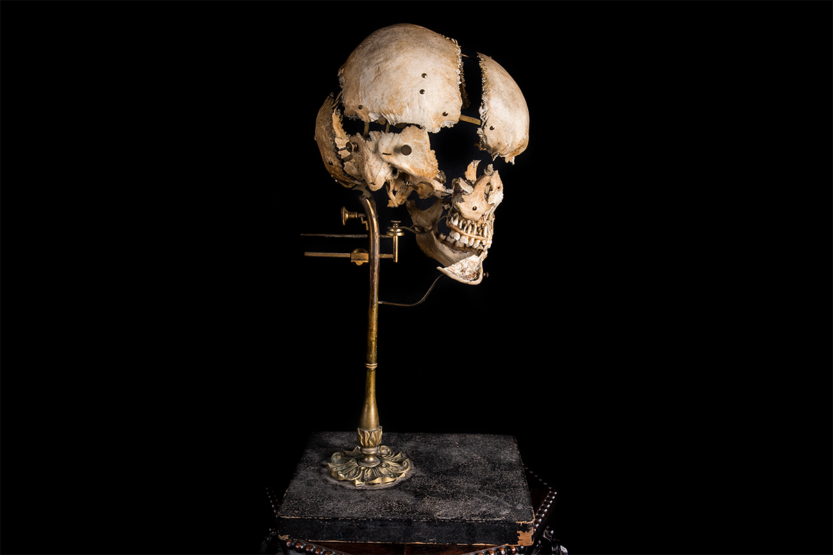 Beauchene Human Exploding Skull