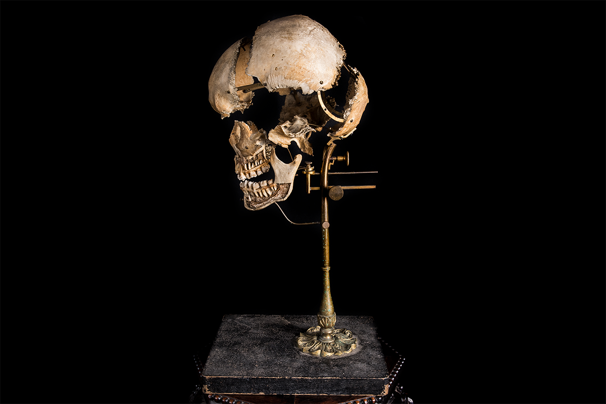 Beauchene Human Exploding Skull
