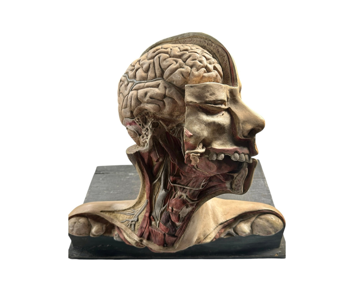 Vintage Anatomical Medical Teaching Model