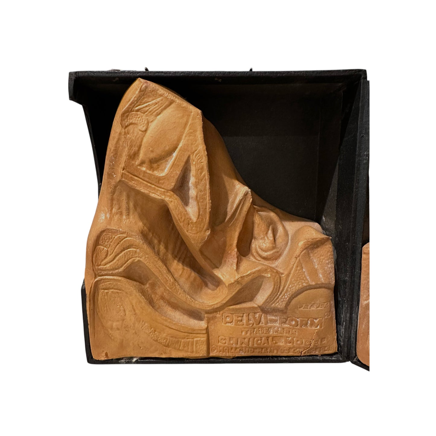 PELVI-FORM Vintage Clinical Teaching Model