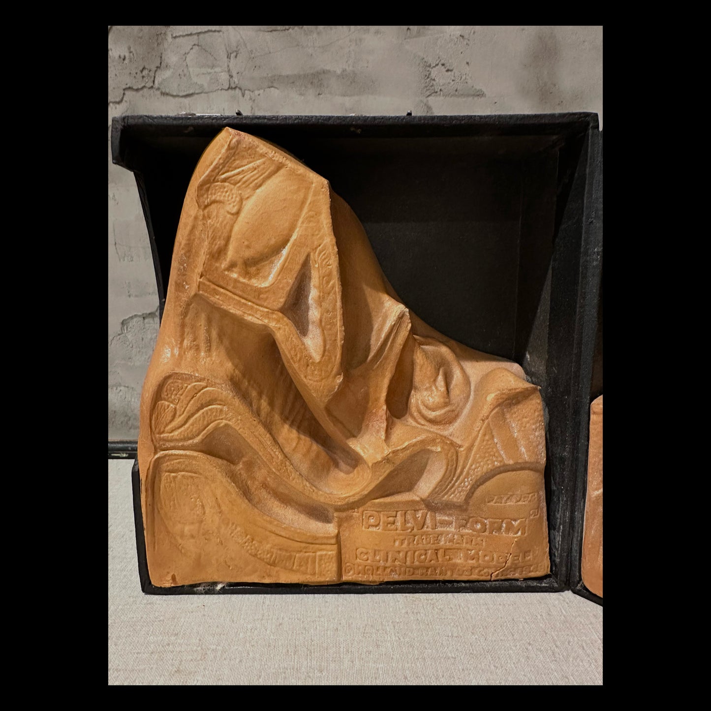 PELVI-FORM Vintage Clinical Teaching Model