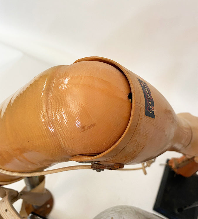 Prosthetic Right Arm