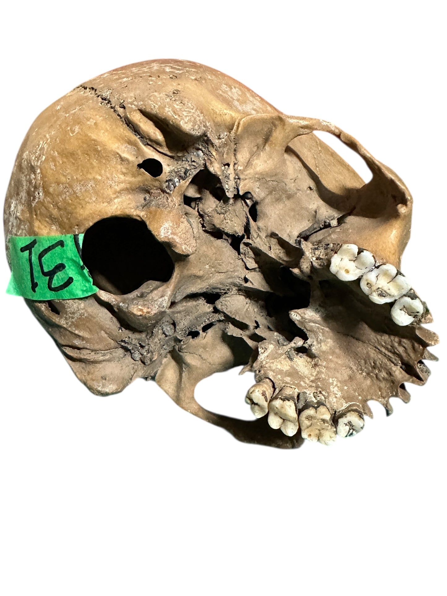 H31 Real Human Skull