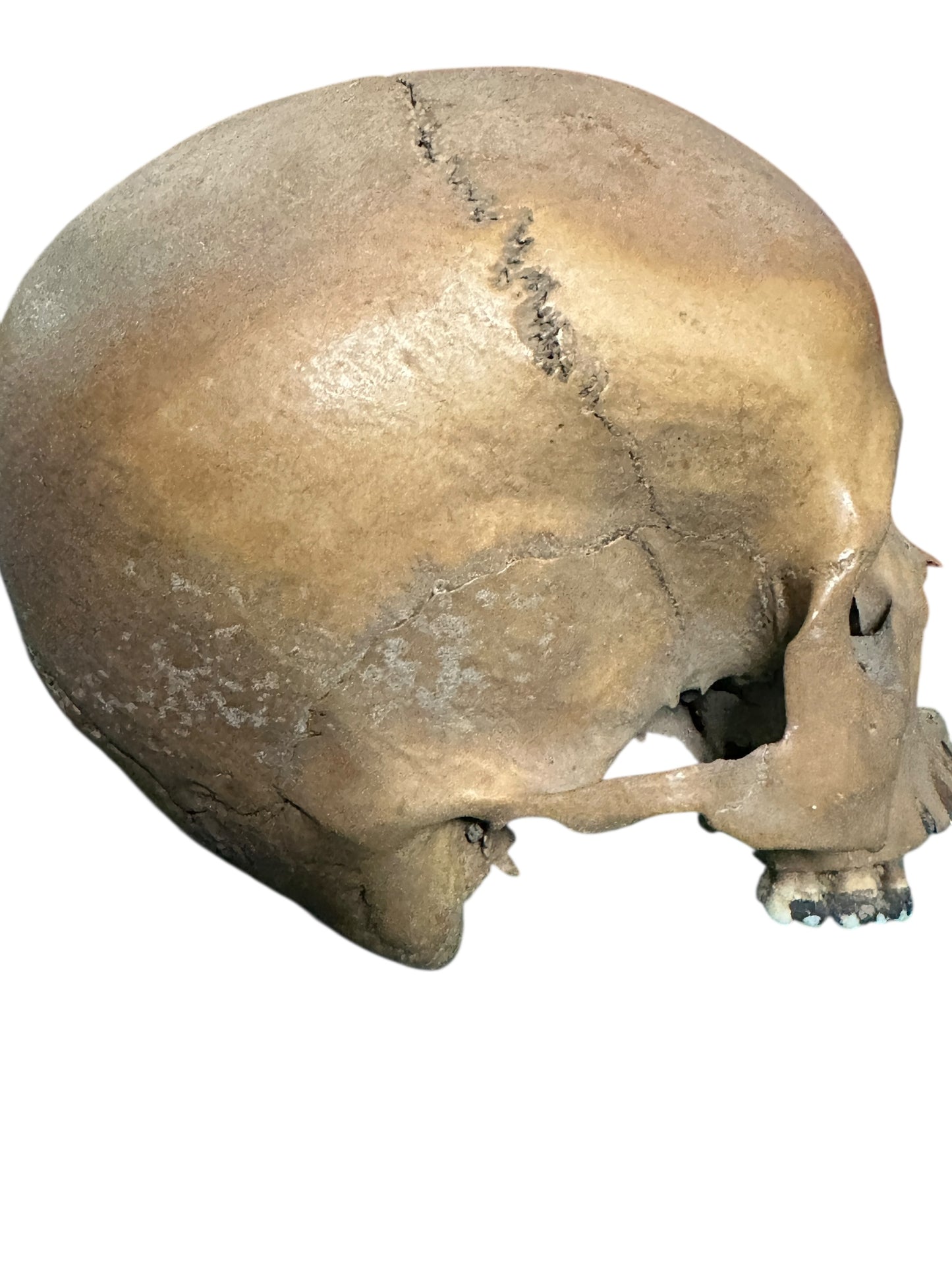 H31 Real Human Skull