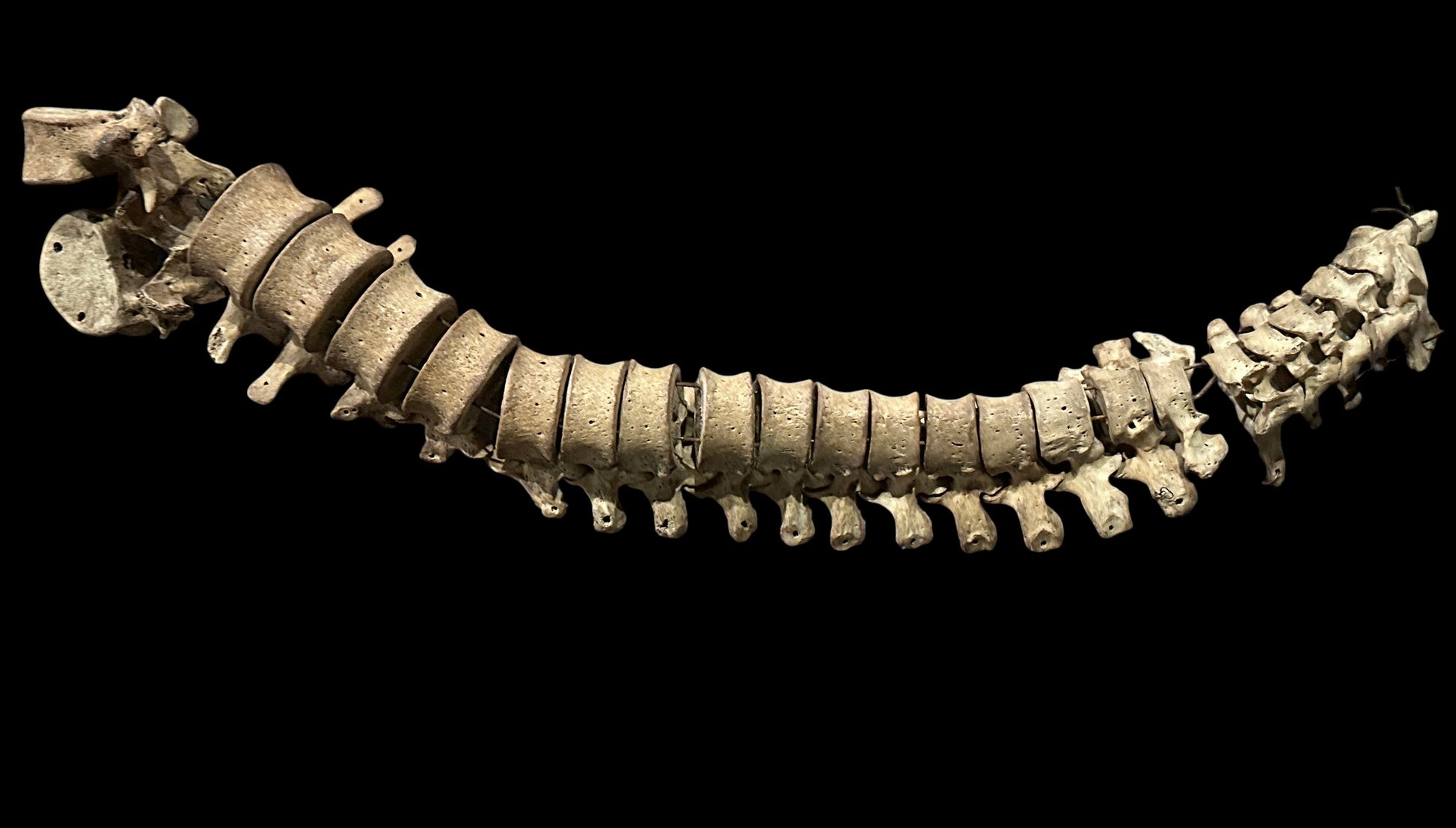 Human vertebrae 