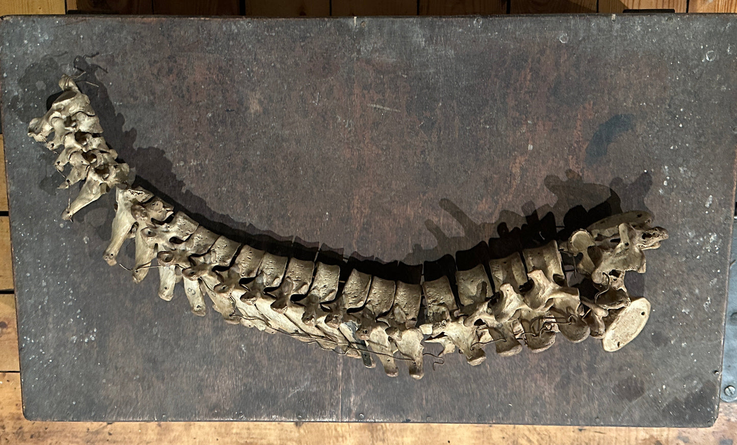 Human Vertabrae Column