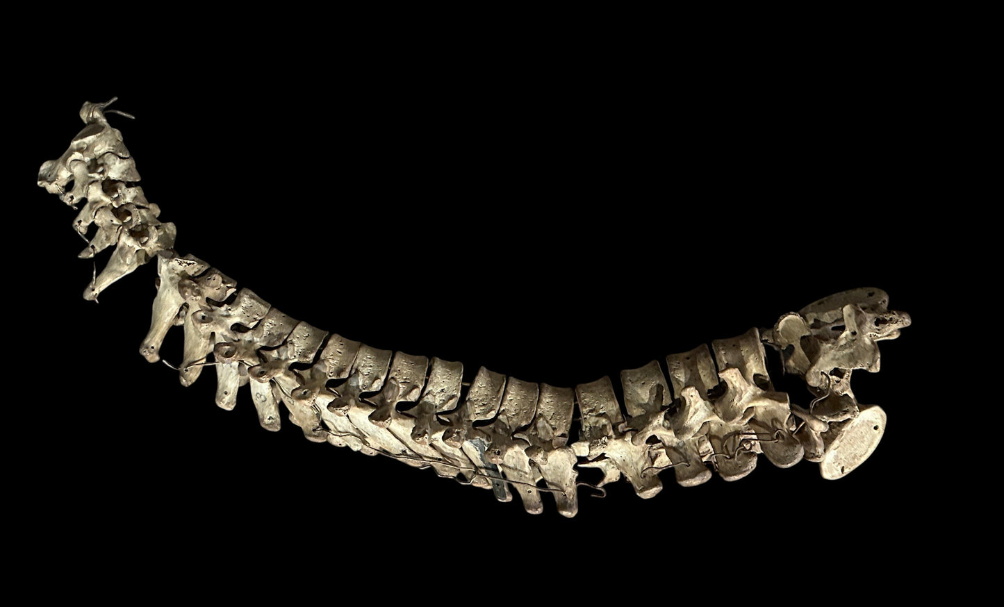 Human Vertabrae Column