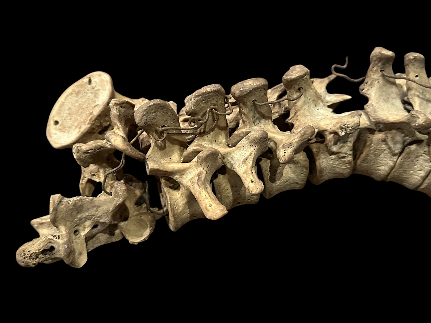 Human Vertabrae Column