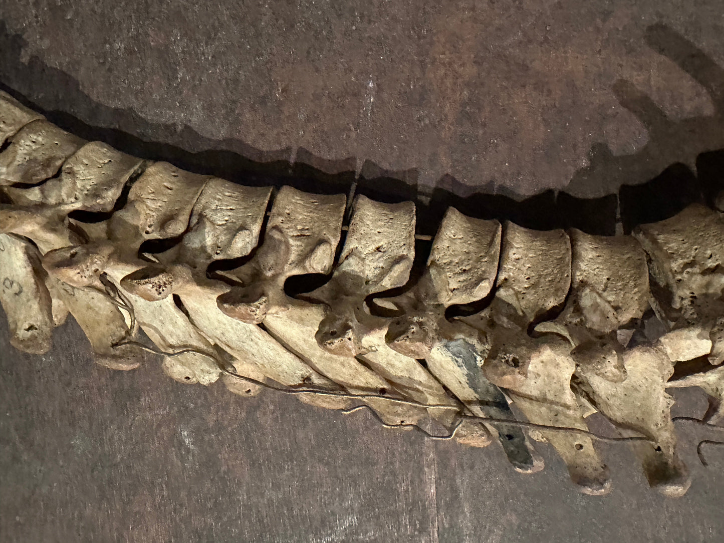Human Vertabrae Column