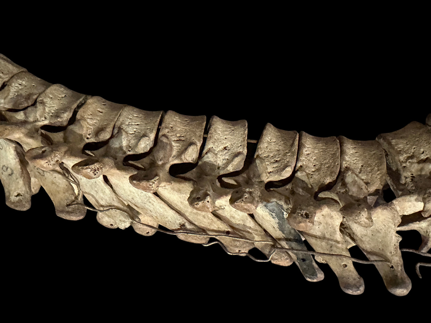 Human Vertabrae Column
