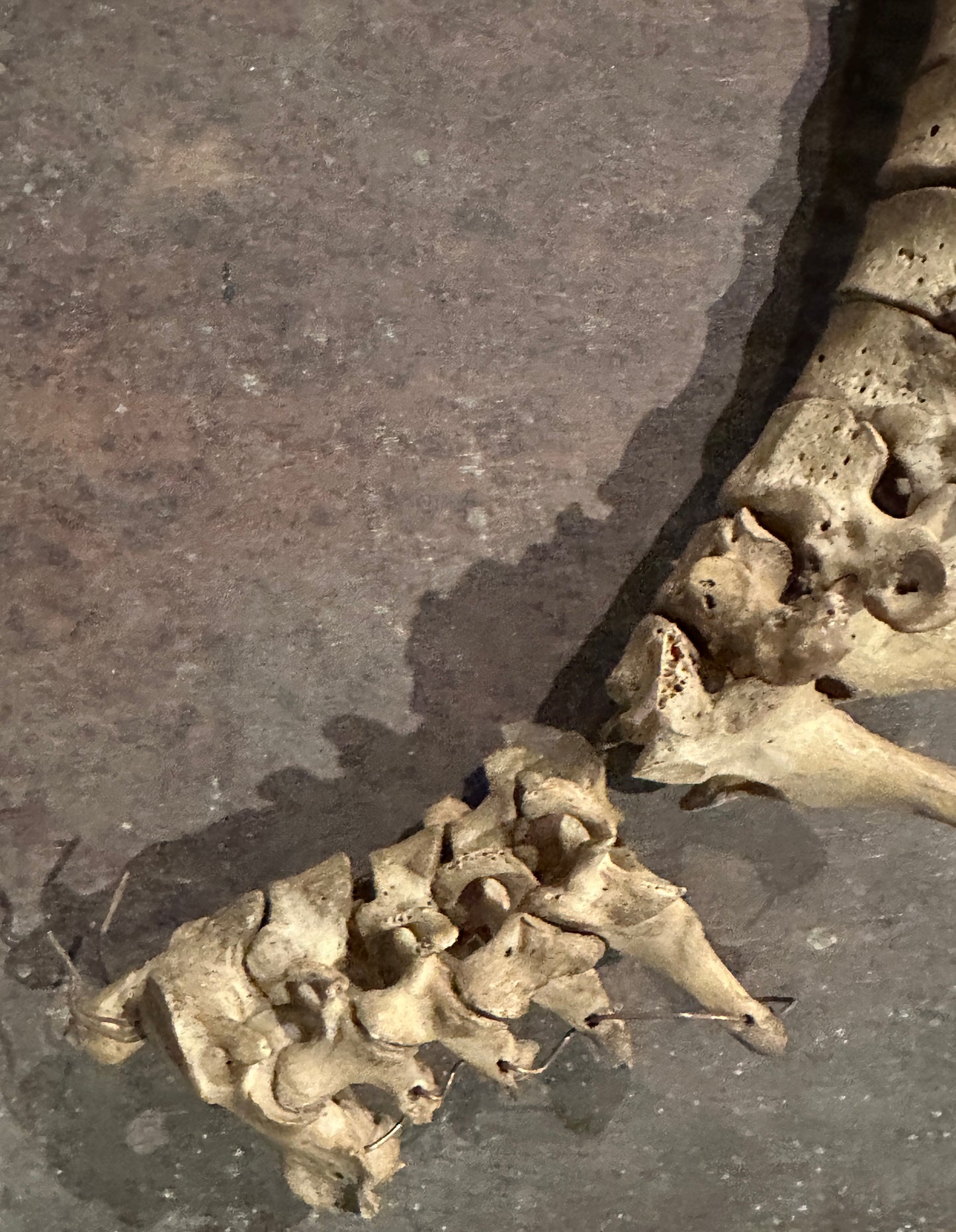 Human Vertabrae Column